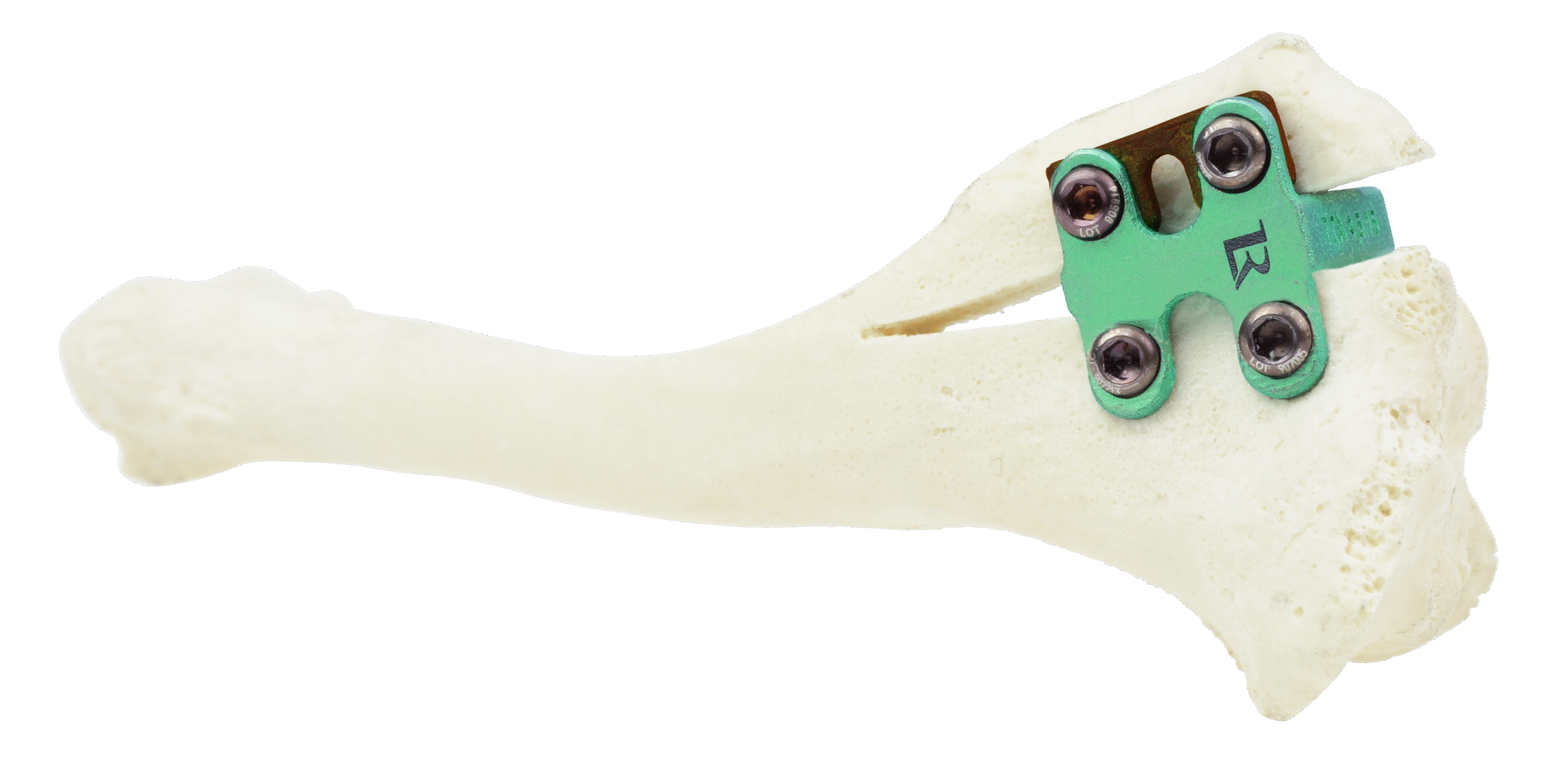 Spacer+TTARapid-Imagebild_1