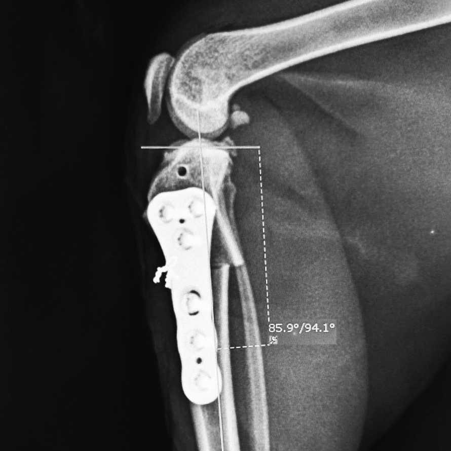 Cranial Closing Wedge Surgery