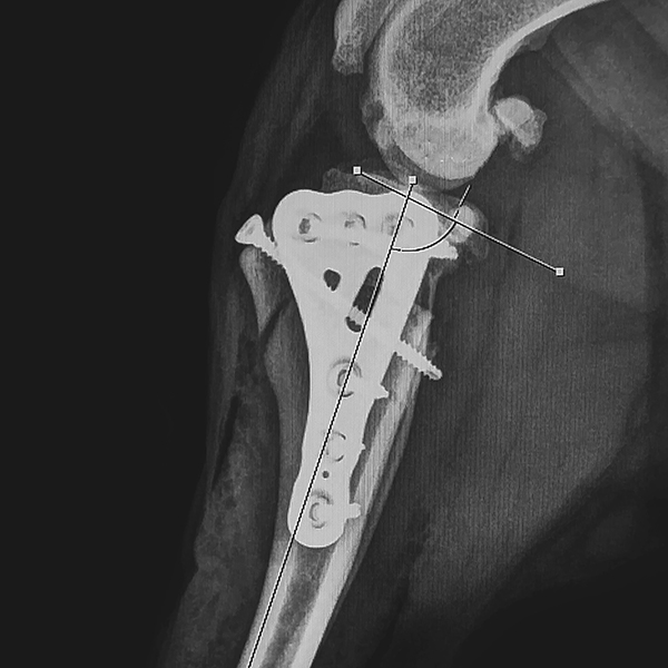 CBLO (CORA Based Leveling Osteotomy)