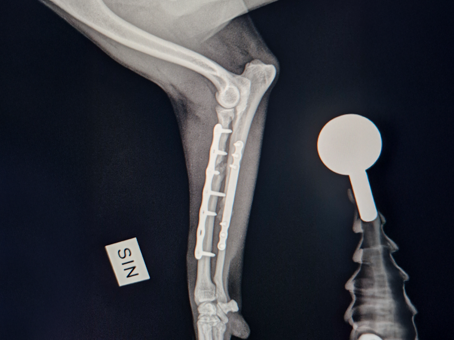 4 - Rita Leibinger Medical - New 1.0 mm LeiLOX Plate