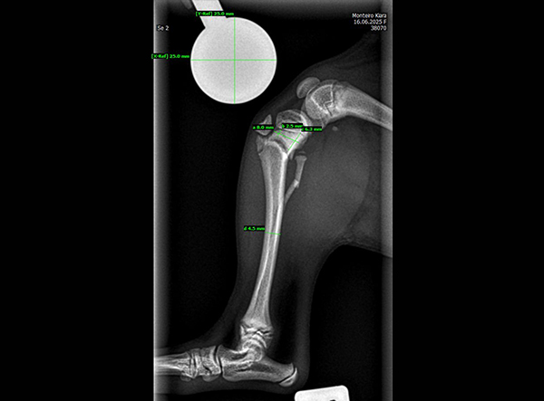 4 - Dr. Weber - 1.5mm RL-TPLO Platte Kopie
