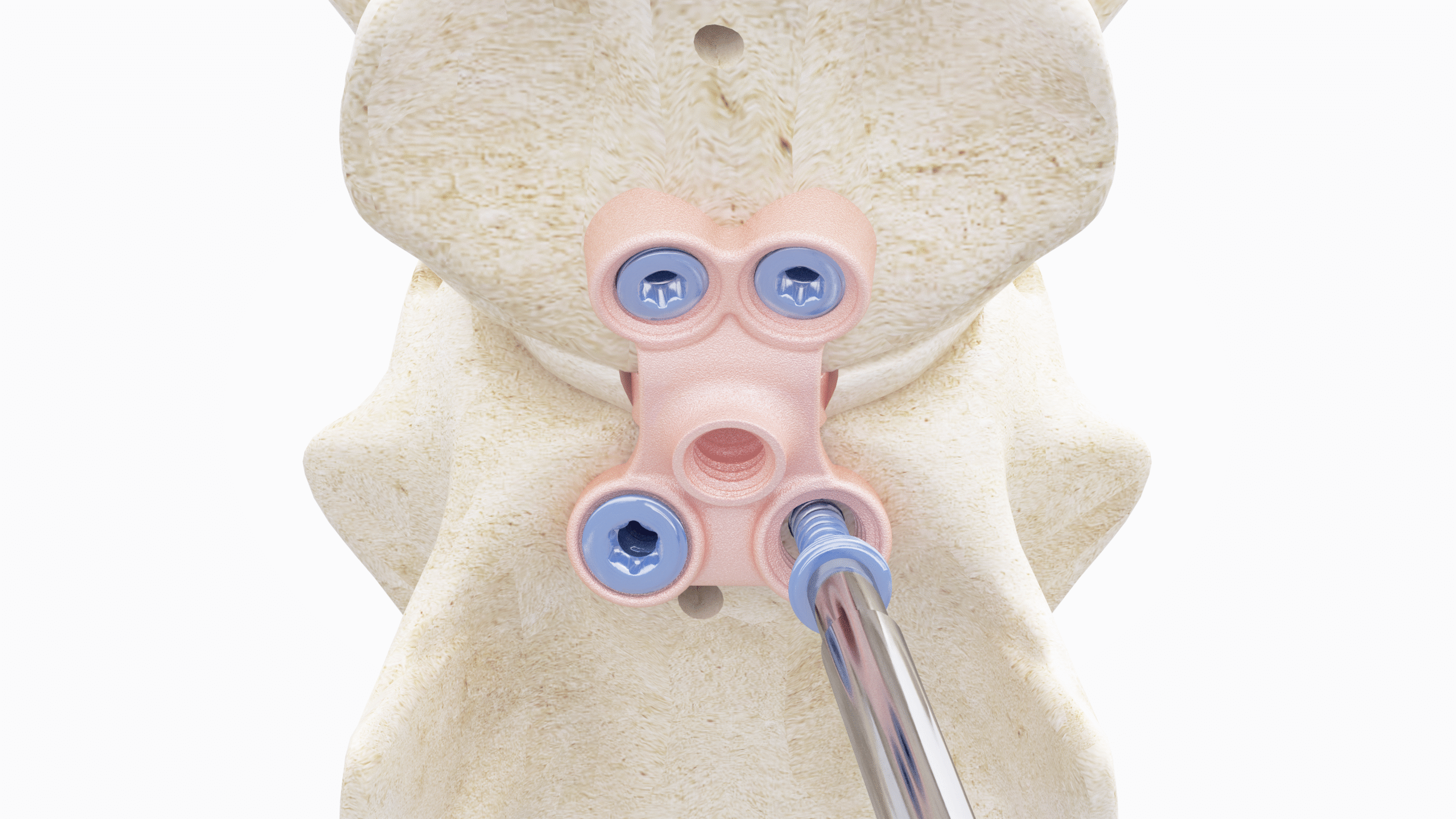 ritaleibinger_imageprint09_synthes3d_v1_edited