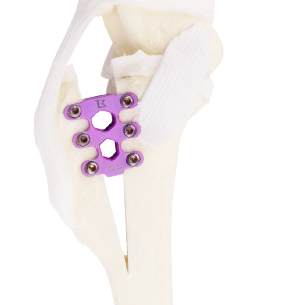 SawBone 1_improved_1x_PNG