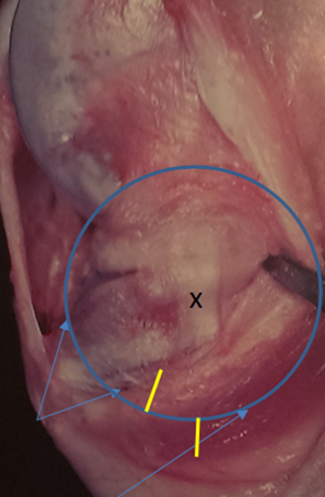 Center of circular cut_2