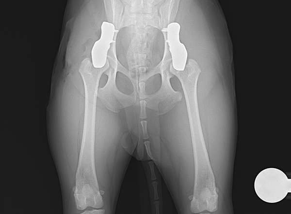 1 - 3D HIP Surgery Iba Shinu