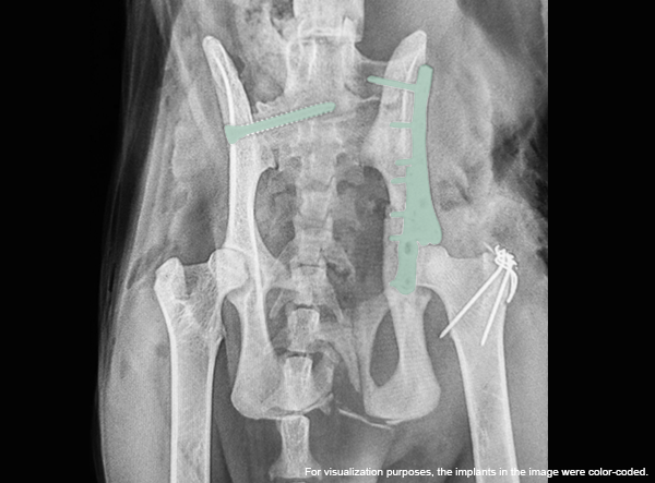 Matan Or_Cat with comminuted Illium and Acetabulum Fracture_2_new