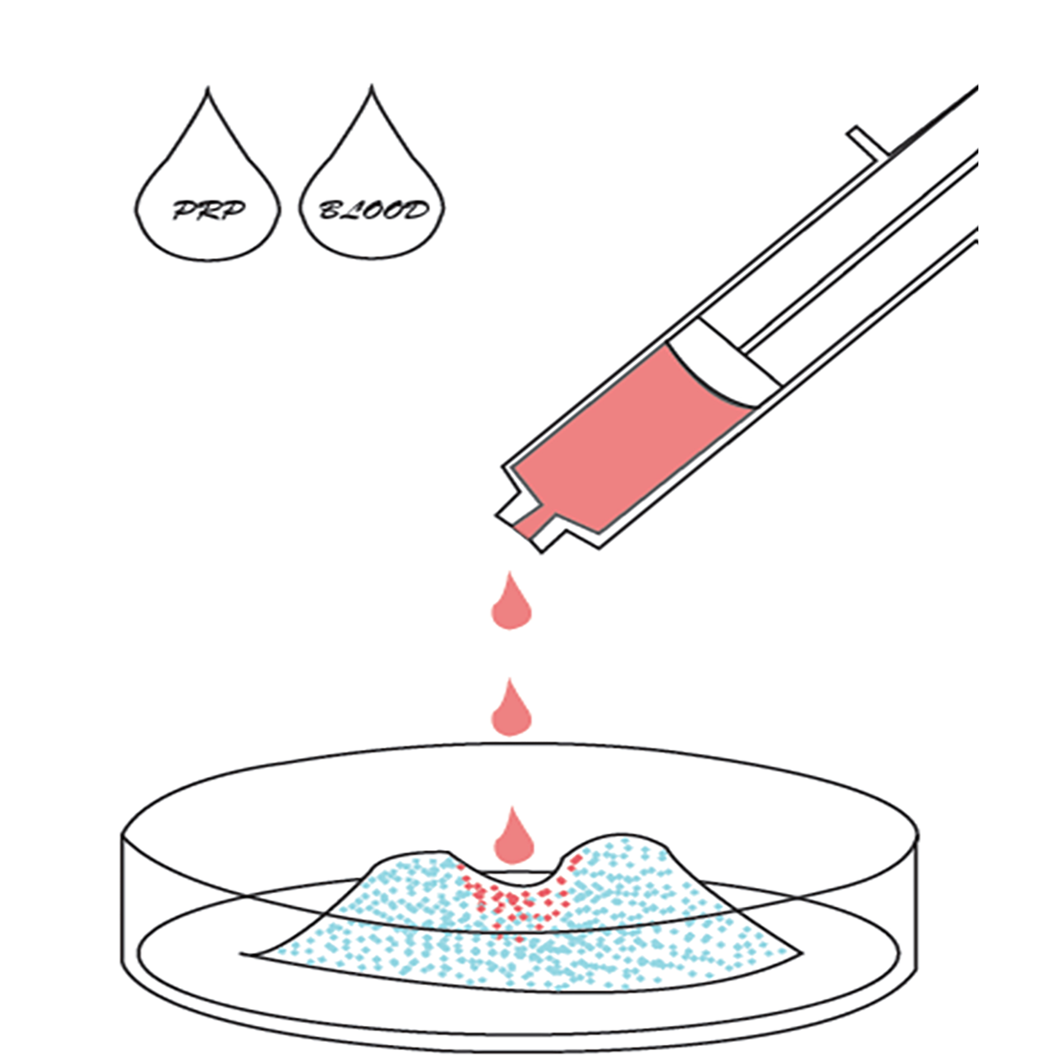 Bone Matter_Application_2