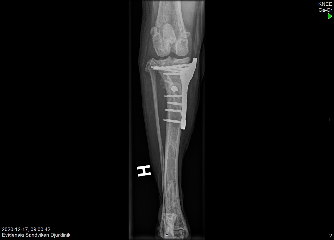 KNEE_20210113_084800