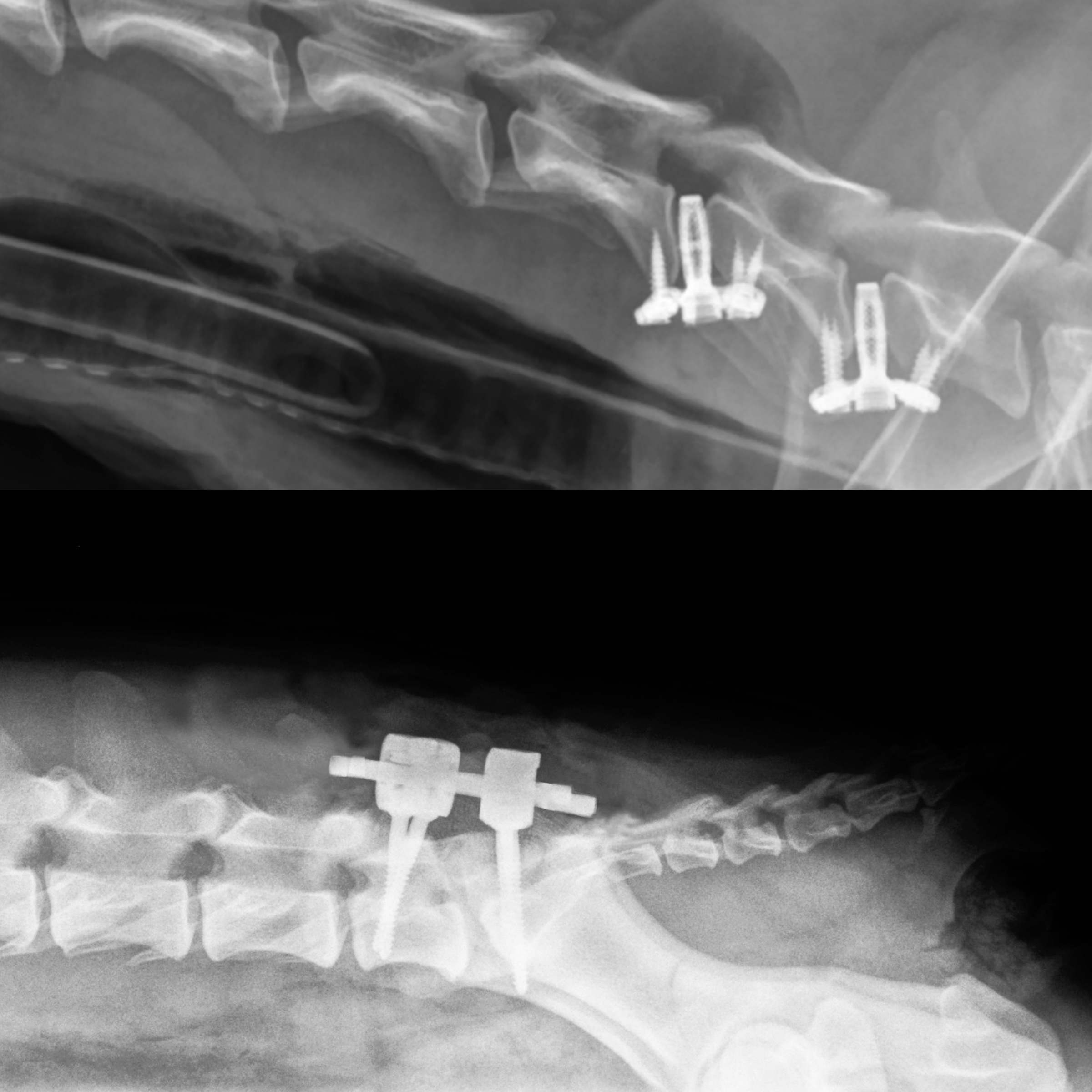 Spinal Surgery 2-Day Advanced Course