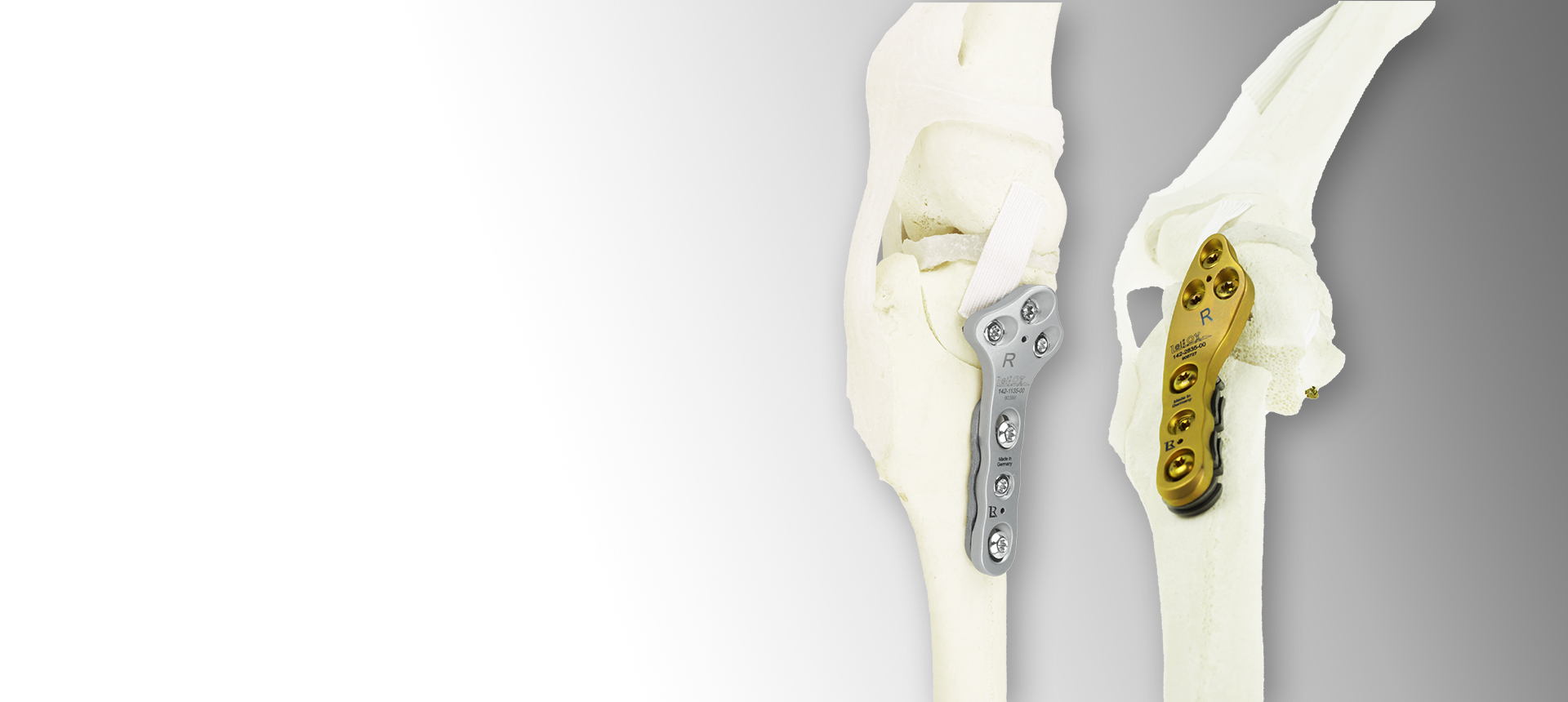 TPLO Patella Luxation Spacers