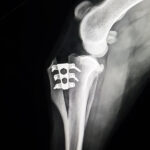 TTA RAPID® & Patella Luxation