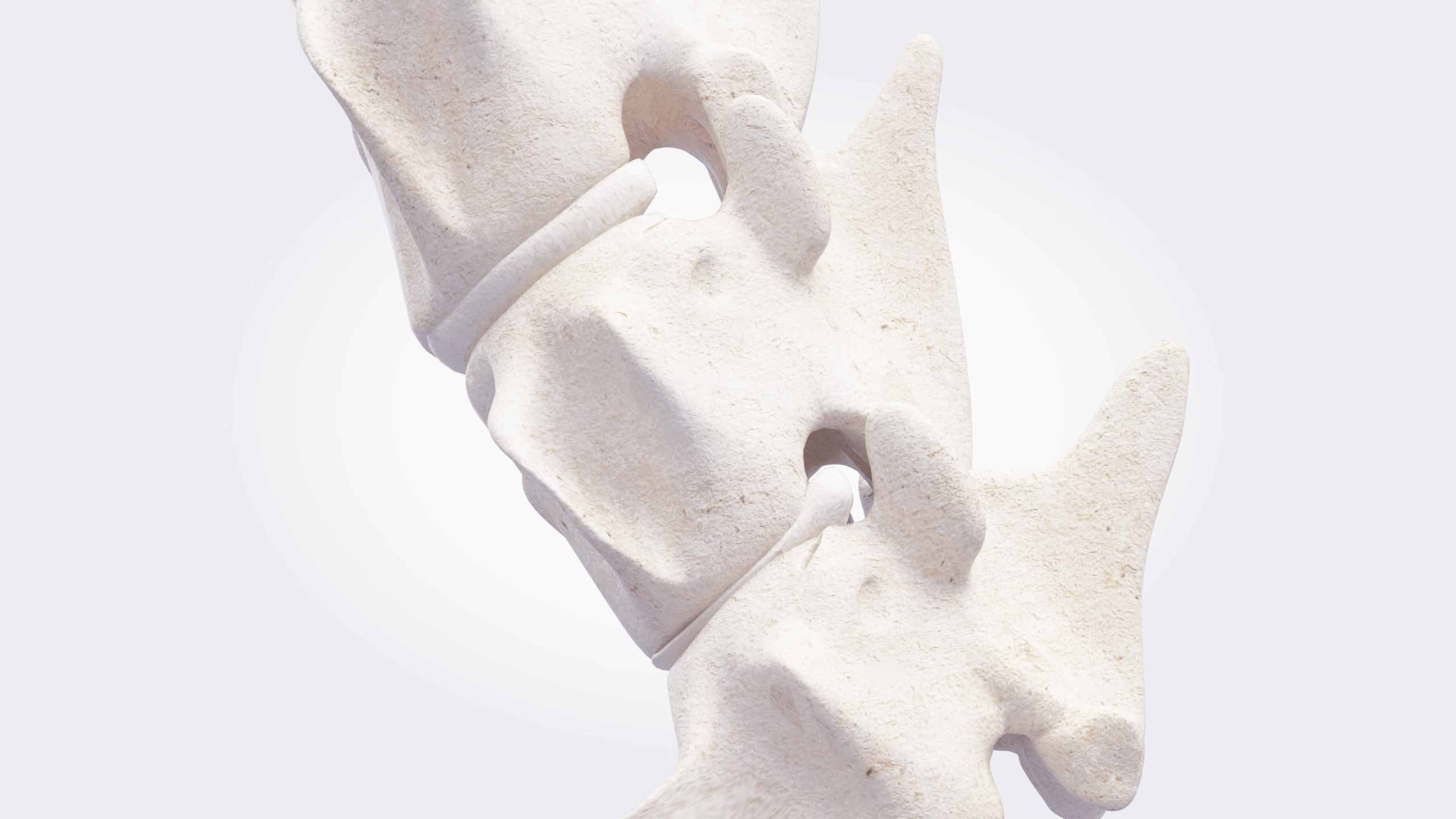 2_Expose affected disc