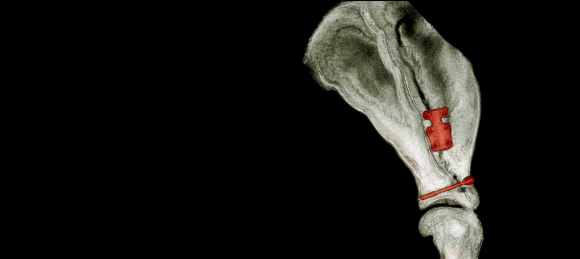 TPLO Patella Luxation Spacers