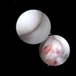 International Arthroscopy Course